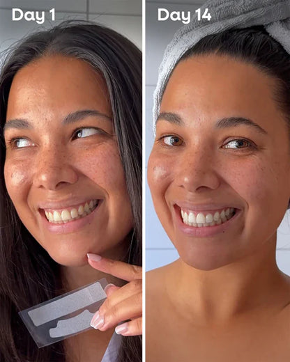 Whitening Strips - Aloe - 28 Strips